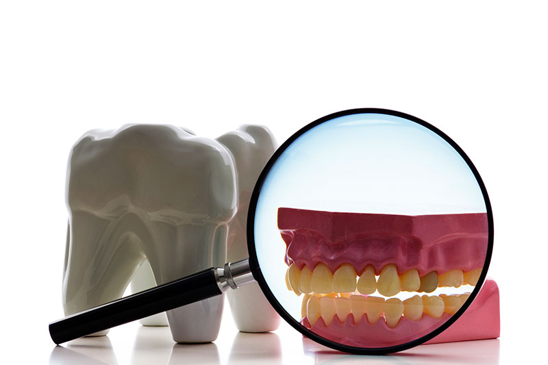 Root Canal Treatment in San Antonio