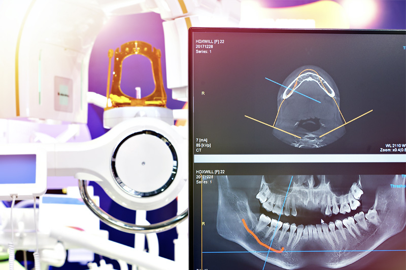 Digital Radiographs in San Antonio