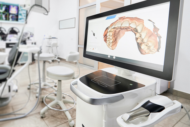 Intra-Oral Scanner in San Antonio