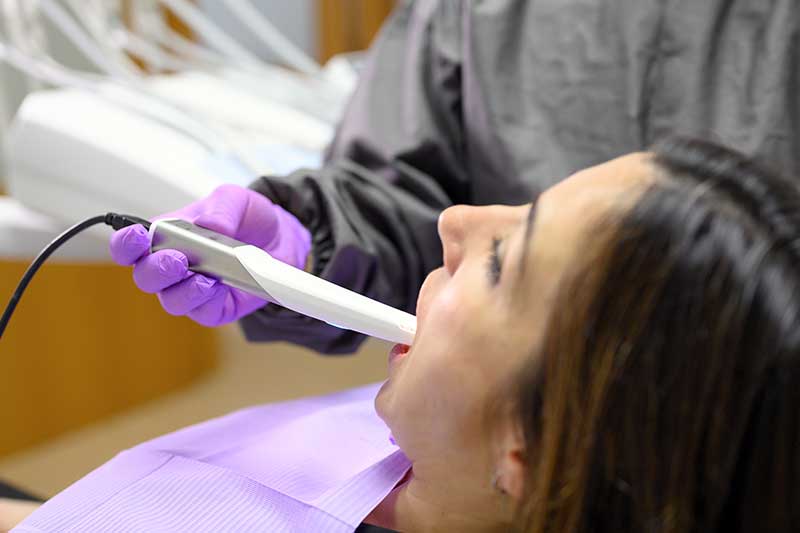 Intra-oral Camera in San Antonio